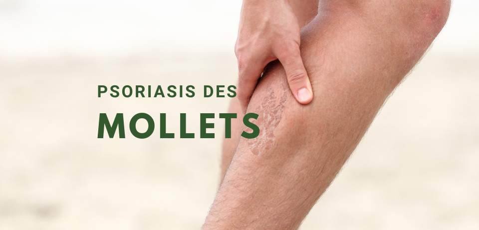 PSORIASIS MOLLETS